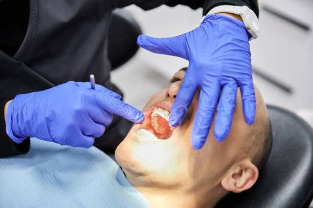Best Emergency Wisdom Tooth Extraction in Sparta, NC
