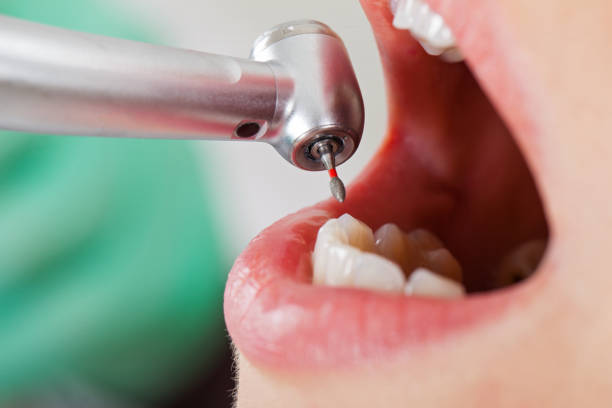 Trusted NC Emergency Dental Service Experts